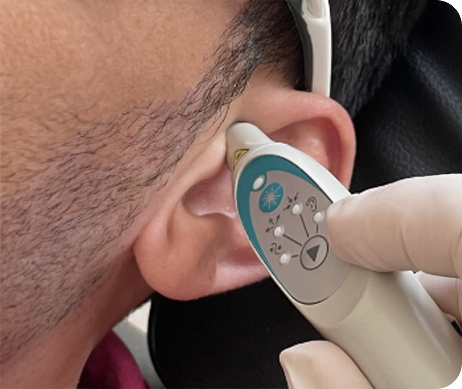 Laser réflexologie auriculaire